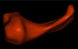 hippocampus/amygdala complex based on spherical harmonics