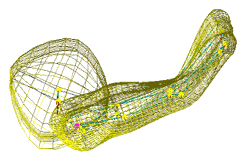 Two-figure m-rep obtained by deforming m-rep                       fit to average case