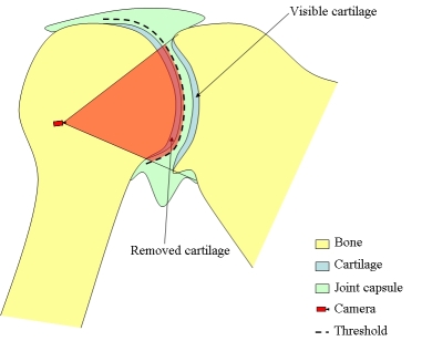 FOR Diagram